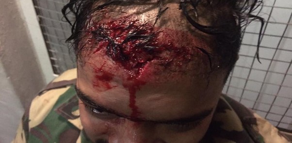 Kay with injured head